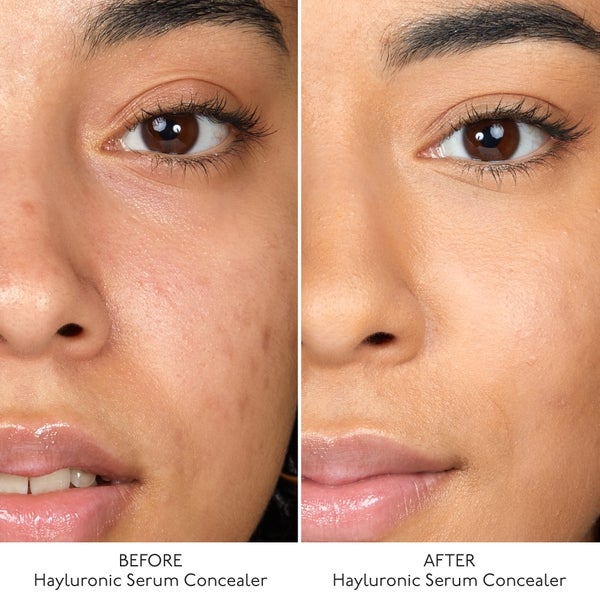 By Terry By Terry Hyaluronic Serum Concealer (Various Shades) Pezzi Unici
