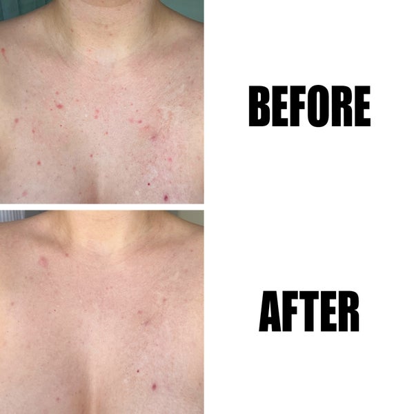 The INKEY List The INKEY List Glycolic Acid Exfoliating Body Stick 45g Qualità Garantita