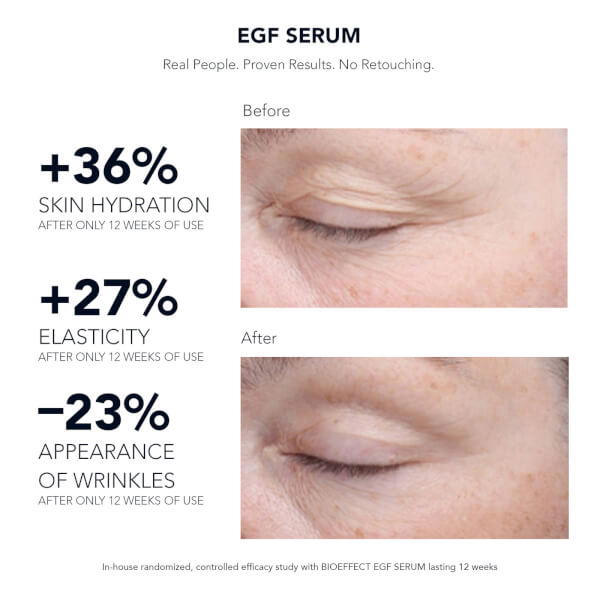 BIOEFFECT BIOEFFECT EGF Serum 15ml Prezzo Ridotto
