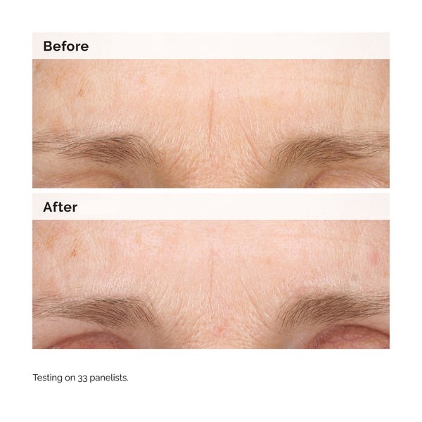 The Ordinary The Ordinary Retinal 0.2% Emulsion 15ml Enormi sconti